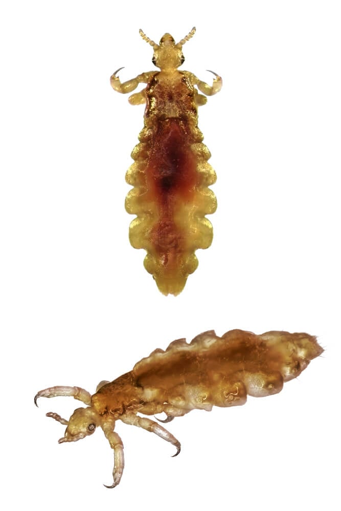 headlice diagram from multiple angles